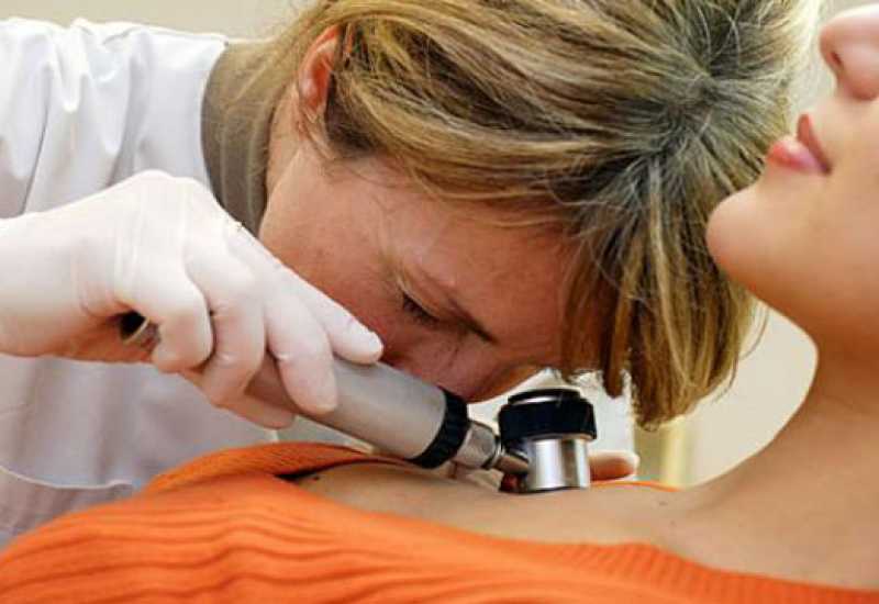 Preventivni besplatni pregledi i posebna pažnja kože i uma nakon dijagnostike karcinoma kože