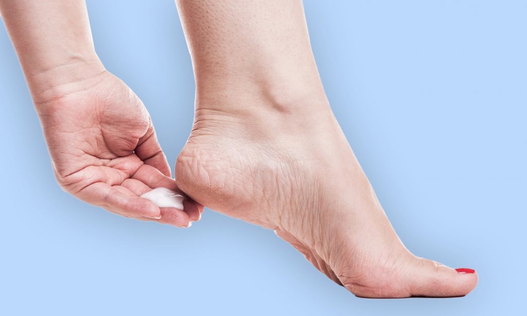 Kako da se riješite ispucale kože na stopalima nakon ljeta